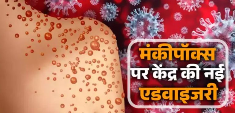 देश में MPOX का जानलेवा स्ट्रेन मिलने के बाद ऐक्शन में केंद्र, राज्यों के लिए जारी की नई एडवाइजरी