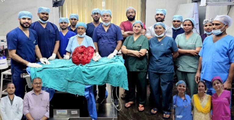 सफदरजंग अस्पताल में 10.6 किलोग्राम का विशाल गैस्ट्रोइंटेस्टाइनल स्ट्रोमल ट्यूमर सफलतापूर्वक निकाला गया
